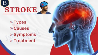 what causes a stroke